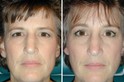 Example of Transformation