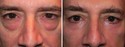 Before and After Treatment