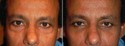Before and After Treatment