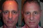 male cosmetic surgery