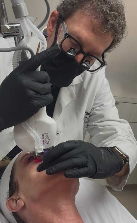 Dr. Adam Scheiner performing a Halo Tribrid laser treatment.